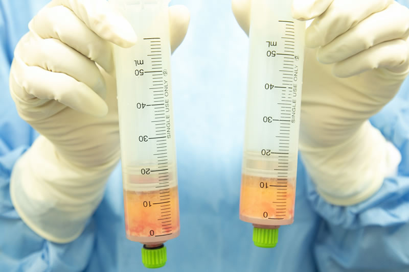 コンデンスリッチの脂肪